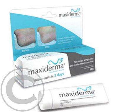 Maxiderma Balzám na paty a chodidla 56g