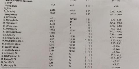 Lymfocytopenia? Nizka hodnota lymfocytov v krvi