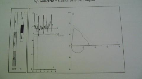 Vyšetrenie spiro